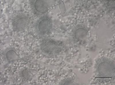 Aspergillus fumigatus..